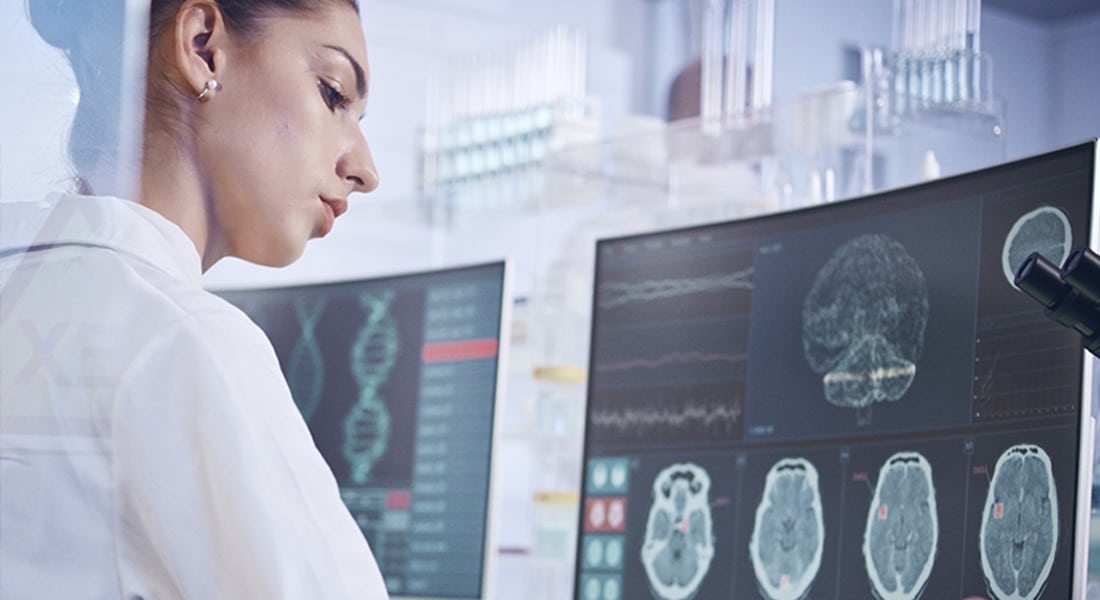 A scientist looking at brain scans on a computer screen.